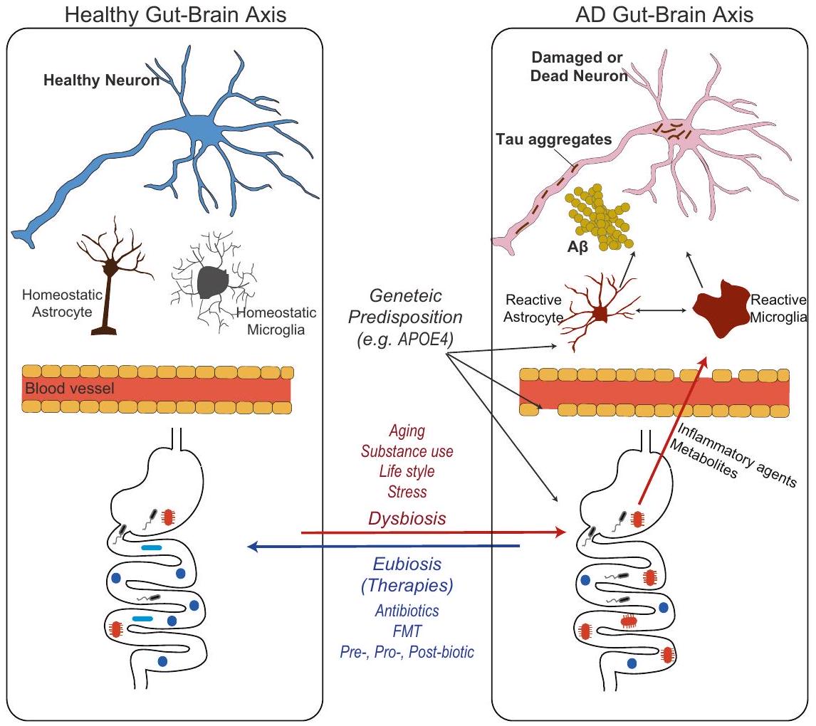 الفهم الحالي للميكروبيوم المرتبط بمرض الزهايمر والاستراتيجيات العلاجية Current understanding of the Alzheimer’s disease-associated microbiome and therapeutic strategies