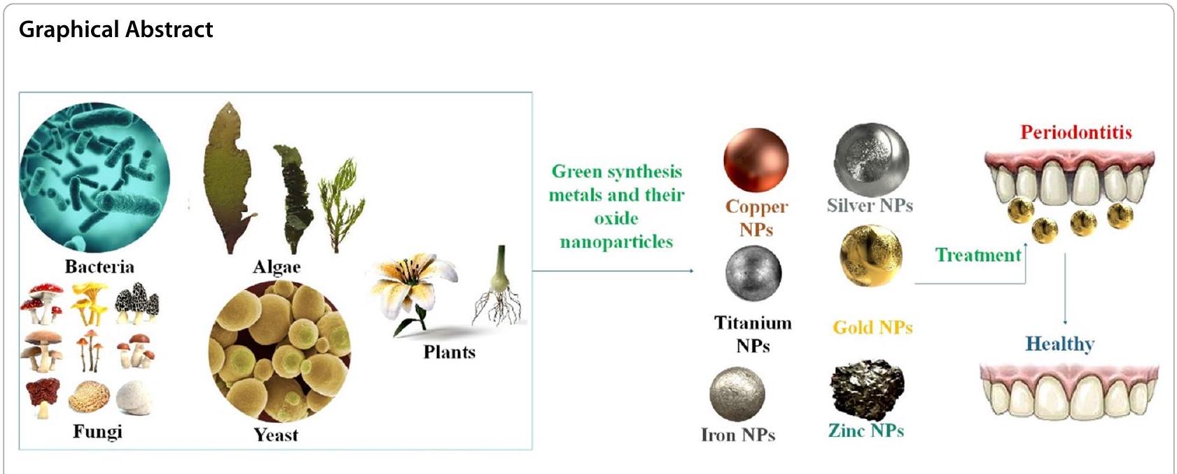 تسليط الضوء على الكفاءة العلاجية للمعادن التي تم تصنيعها بطريقة خضراء وجزيئات أكسيدها النانوية في التهاب اللثة Spotlight on therapeutic efficiency of green synthesis metals and their oxide nanoparticles in periodontitis