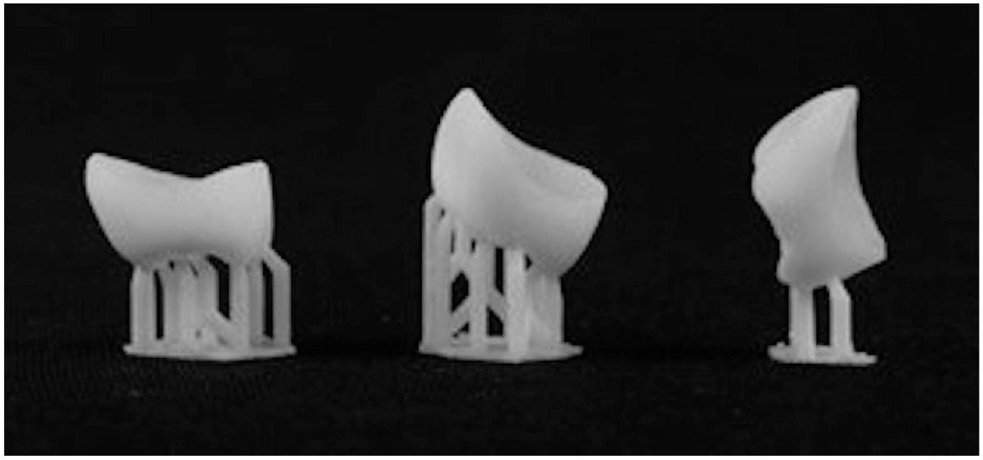 تأثير زاوية البناء على ملاءمة حواف التيجان السنية المطبوعة بتقنية الطباعة ثلاثية الأبعاد باستخدام معالجة الضوء الرقمي وتقنية الاستريوليثوغرافي: دراسة مخبرية Build angle effect on 3D-printed dental crowns marginal fit using digital light-processing and stereo-lithography technology: an in vitro study