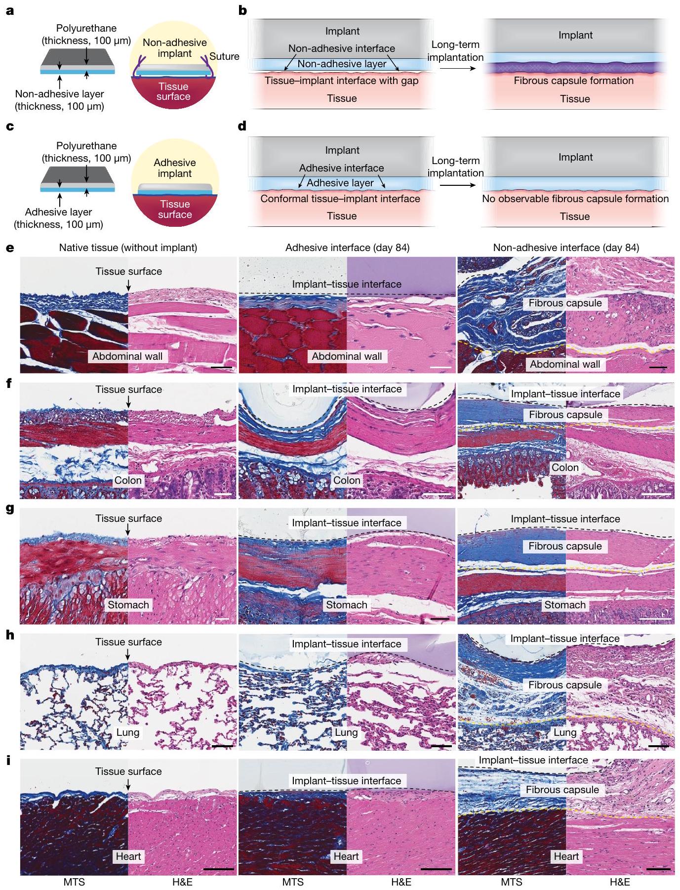 واجهات لاصقة مضادة للتليف على أعضاء متنوعة Adhesive anti-fibrotic interfaces on diverse organs