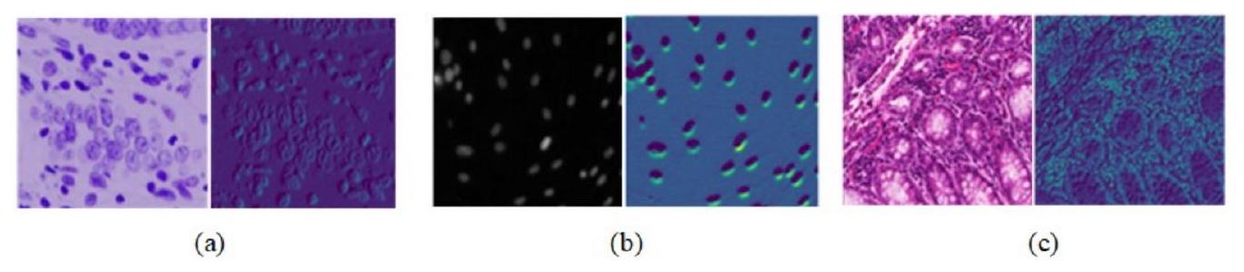 ASF-YOLO: نموذج YOLO جديد مع دمج تسلسل المقياس الانتباهي لتجزئة حالات الخلايا ASF-YOLO: A novel YOLO model with attentional scale sequence fusion for cell instance segmentation