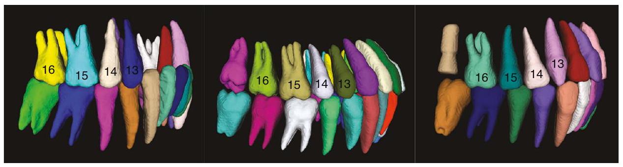التقسيم التلقائي الكامل بالذكاء الاصطناعي للأنسجة المتعلقة بجراحة الفم استنادًا إلى صور الأشعة المقطعية المخروطية Fully automatic AI segmentation of oral surgery-related tissues based on cone beam computed tomography images