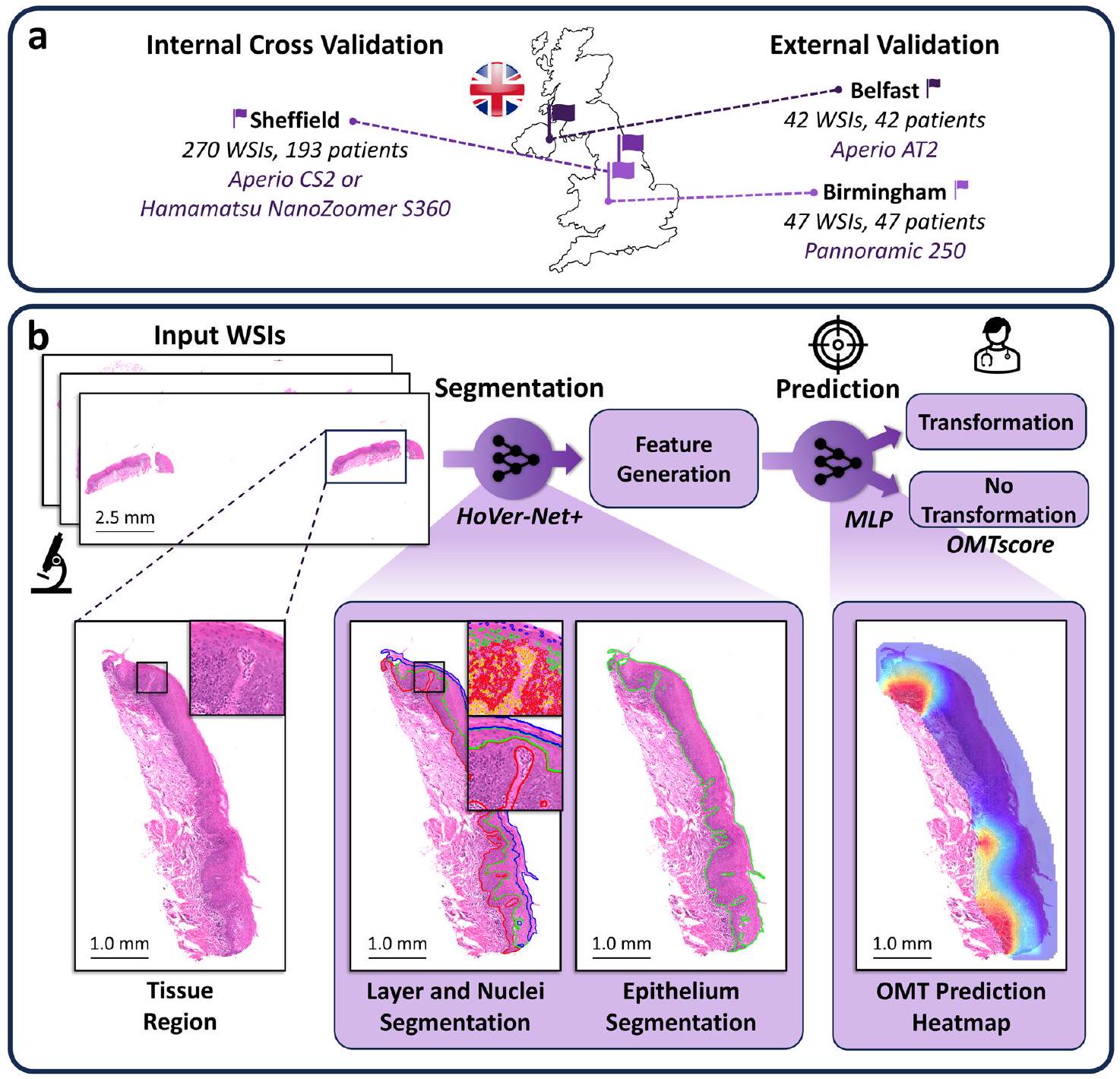 خوارزمية مؤتمتة بالكامل وقابلة للتفسير للتنبؤ بالتحول الخبيث في خلل التنسج الظهاري الفموي A fully automated and explainable algorithm for predicting malignant transformation in oral epithelial dysplasia
