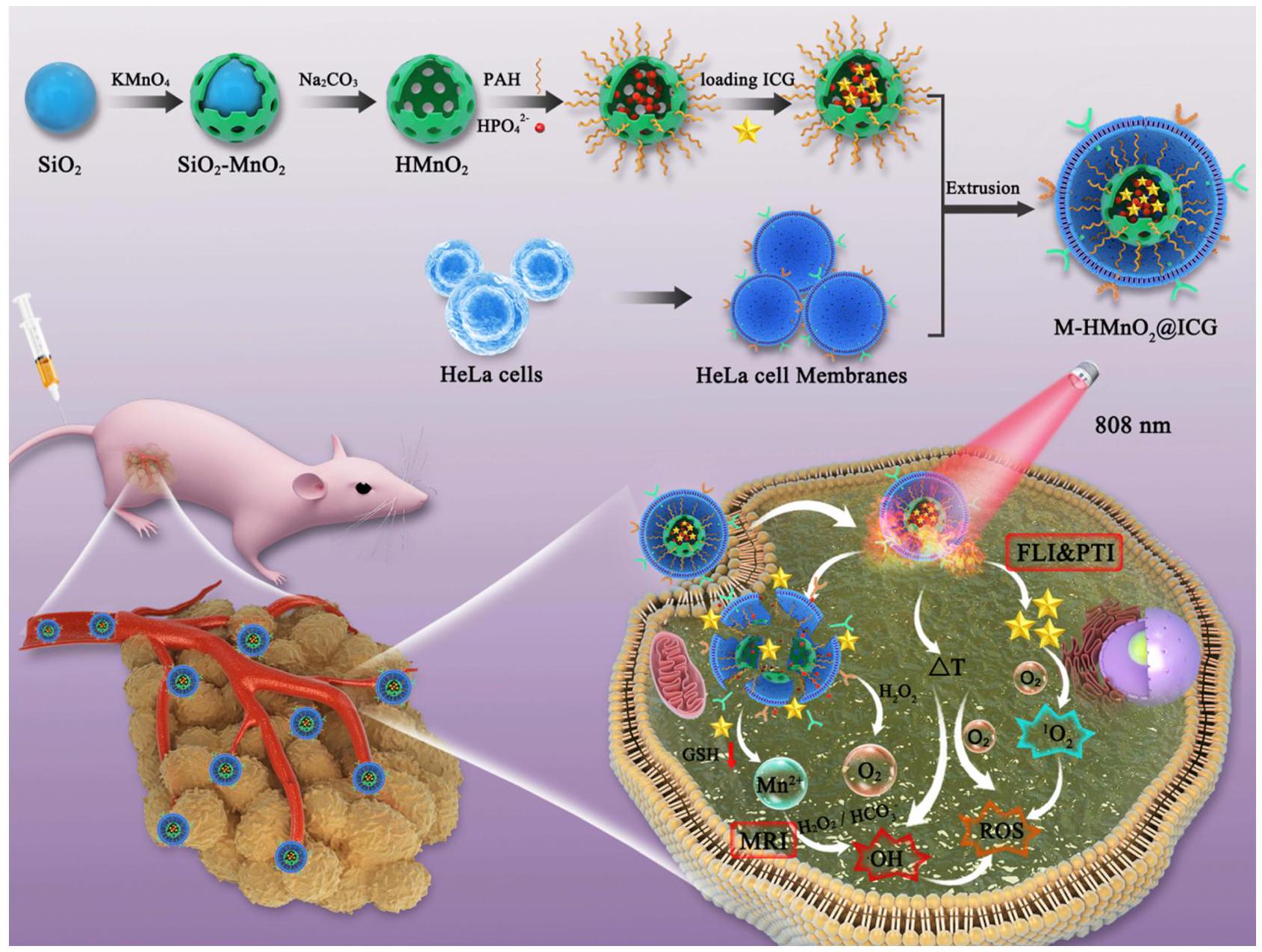 منصات نانوية تستهدف خلايا الورم وتستجيب للبيئة الدقيقة للورم للعلاج متعدد الأنماط الموجه بالتصوير الضوئي الديناميكي/الحراري الضوئي/الديناميكي الكيميائي لسرطان عنق الرحم Tumor Cell-Targeting and Tumor Microenvironment–Responsive Nanoplatforms for the Multimodal Imaging-Guided Photodynamic/Photothermal/Chemodynamic Treatment of Cervical Cancer