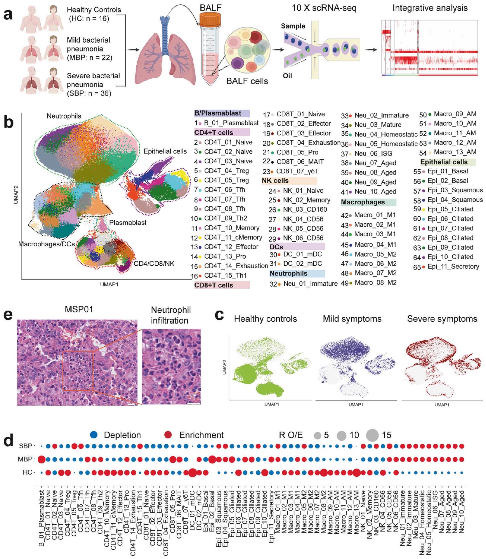 بانوراما مناعية شاملة للالتهاب الرئوي البكتيري تكشفها خريطة تعبير الجينات على مستوى الخلية الواحدة على نطاق واسع A pan-immune panorama of bacterial pneumonia revealed by a large-scale single-cell transcriptome atlas