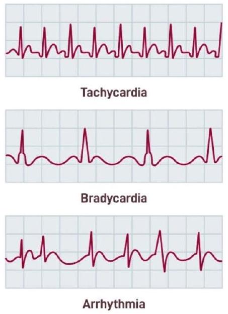 تعزيز تصنيف أمراض القلب استنادًا إلى خوارزمية تحسين الإوز الرمادي وذاكرة المدى الطويل والقصير Enhancing heart disease classification based on greylag goose optimization algorithm and long short-term memory