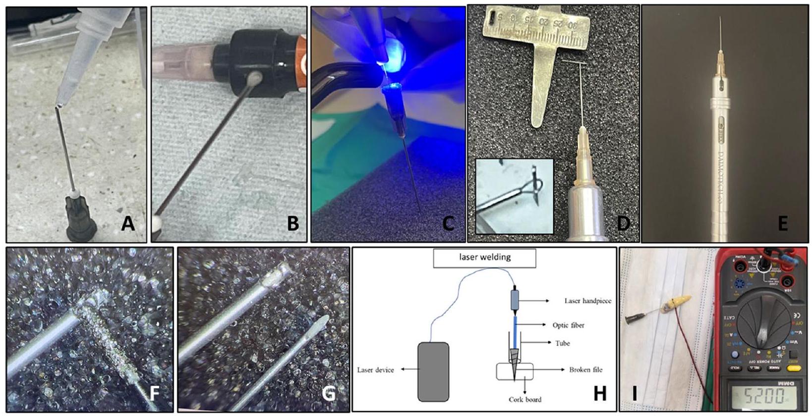 مقارنة قوة السحب لطرق مختلفة تعتمد على الأنابيب الدقيقة في إزالة أدوات الأسنان المكسورة: دراسة مخبرية Comparison of the pull-out force of different microtube-based methods in fractured endodontic instrument removal: An in-vitro study