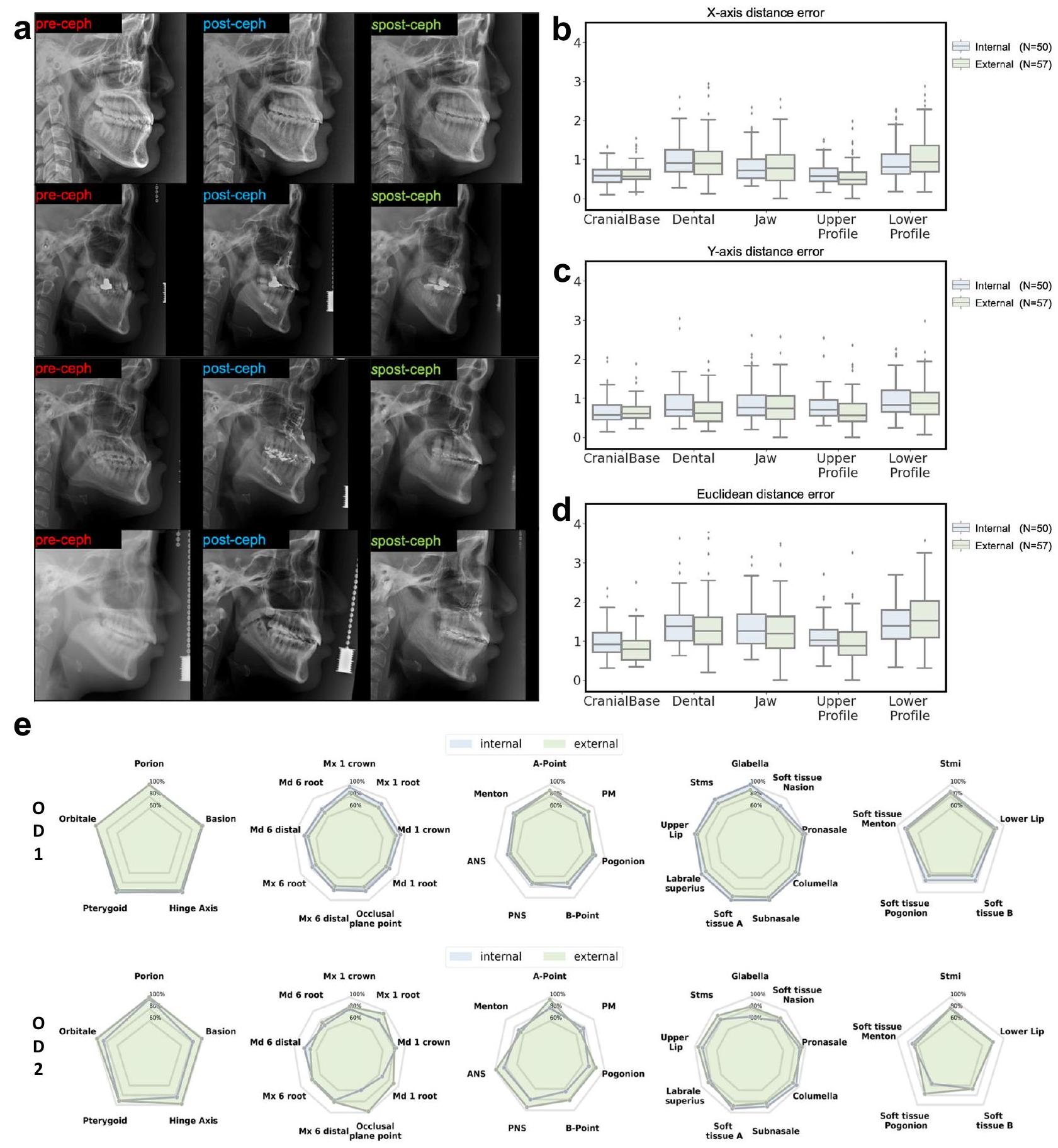 توقع نتائج جراحة الفك العلوي كصور جانبية بعد العملية باستخدام الشبكات العصبية البيانية ونماذج الانتشار Predicting orthognathic surgery results as postoperative lateral cephalograms using graph neural networks and diffusion models