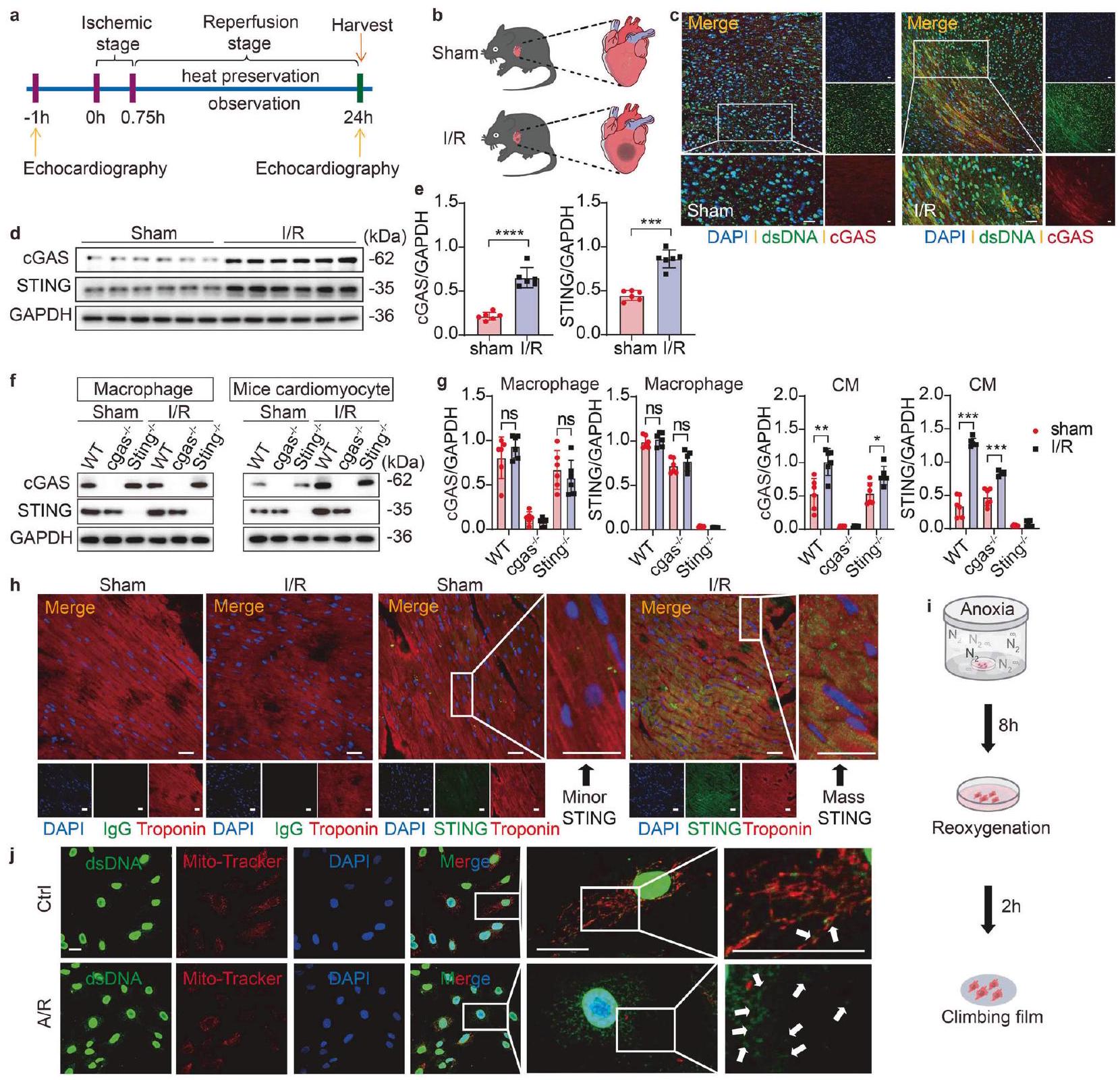 يؤدي STING إلى تفاقم إصابة نقص تروية القلب الناتجة عن الفيروبتوزيس من خلال استهداف GPX4 للتدهور الذاتي. STING aggravates ferroptosis-dependent myocardial ischemia-reperfusion injury by targeting GPX4 for autophagic degradation